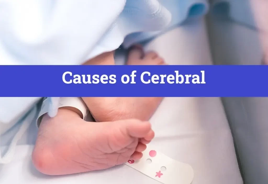 Causes of Cerebral