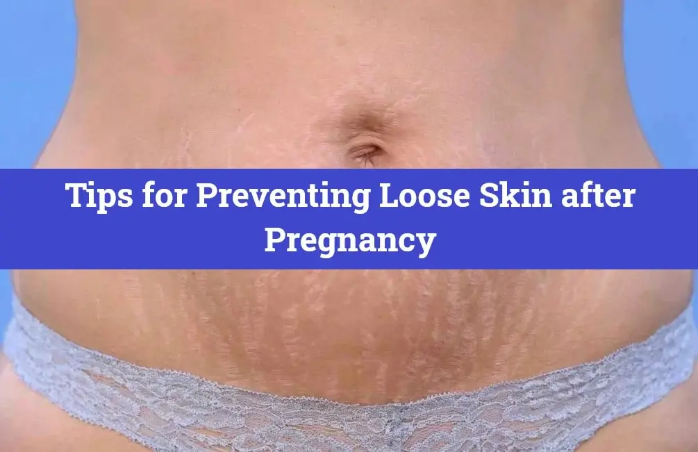 Tips for Preventing Loose Skin after Pregnancy