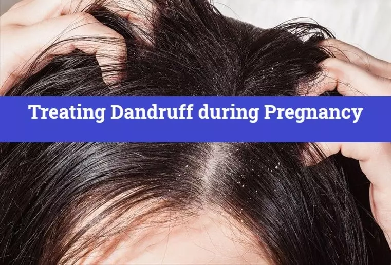 Treating Dandruff during Pregnancy