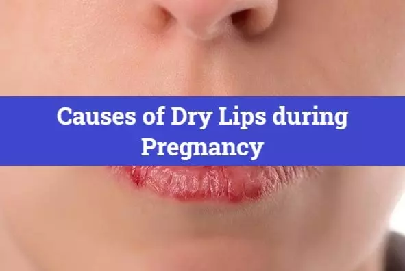 Causes of Dry Lips during Pregnancy