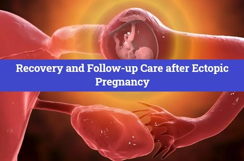 Recovery and Follow-up Care after Ectopic Pregnancy
